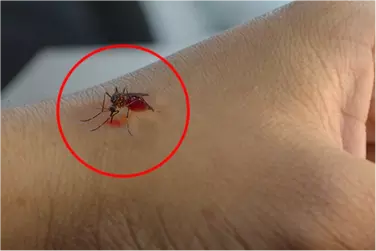 best hospital for dengue treatment in bhawanipur, best doctor for dengue treatment in bhawanipur, cost of dengue treatment in bhawanipurniya.webp